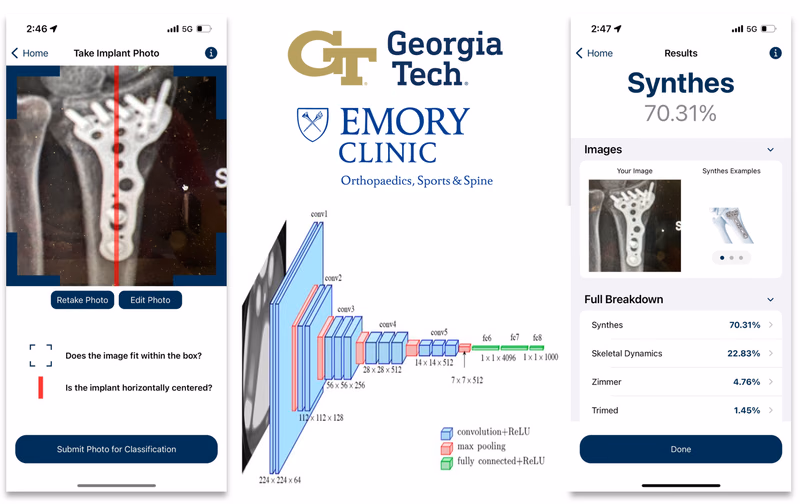 Screenshot visualization of Distal Radius Object Identification (DROID)